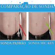 Sonda de Gastrostomia com Válvula anti-refluxo MIC-KEY 12 FR