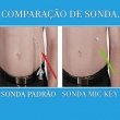 Sonda de Gastrostomia com Válvula anti-refluxo MIC-KEY 